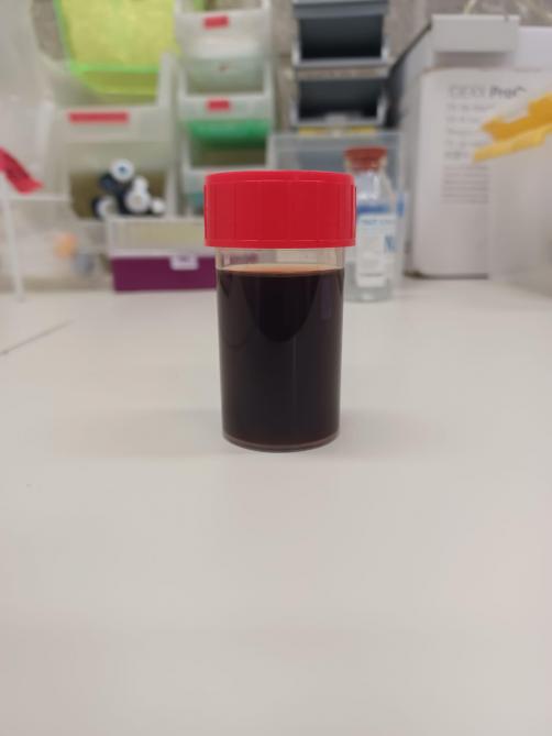 Urine de couleur brun foncé, résultant de la formation de méthémoglobine, découlant elle-même de la présence excessive de cuivre dans le sang.