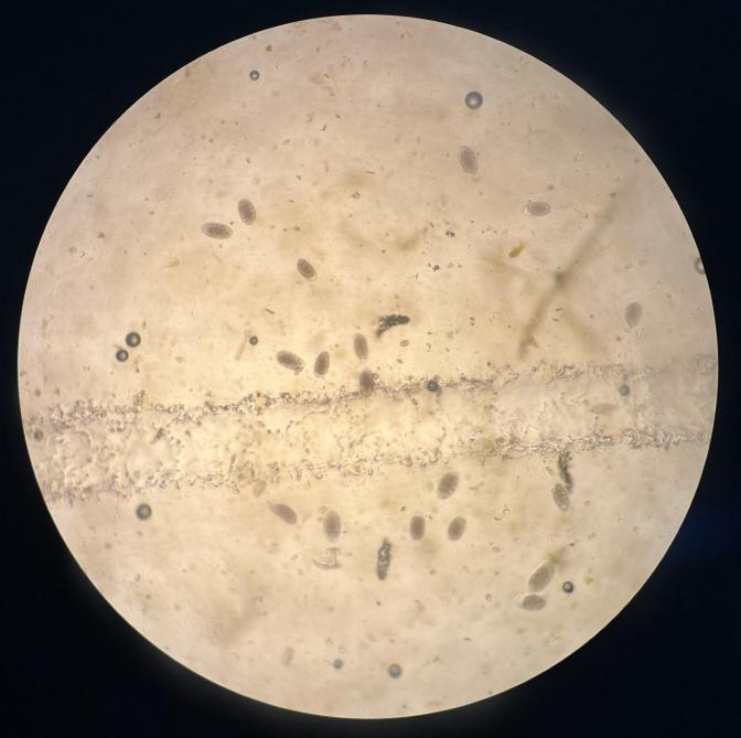Œufs de strongle vus au microscope, après recours à la méthode Flotac.